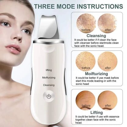 Rechargeable Ultrasonic Skin Scrubber